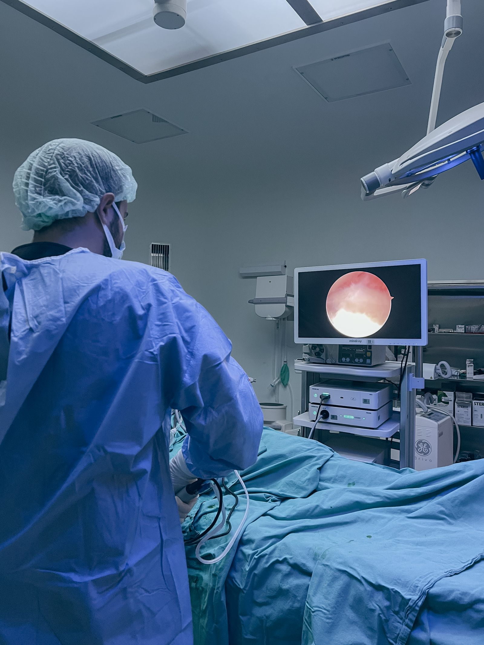 Chirurgie digestive par cœlioscopie, écran de contrôle au bloc